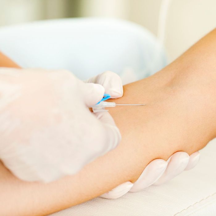 Frequently Asked Questions About IV Therapy - Forge-RX